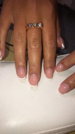 Service : prothesiste ongulaire Service : prothesiste ongulaire