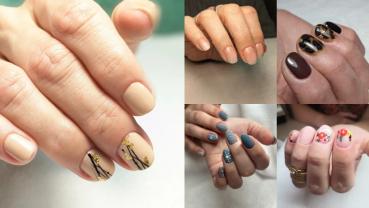 Service : prothesiste ongulaire Service : prothesiste ongulaire