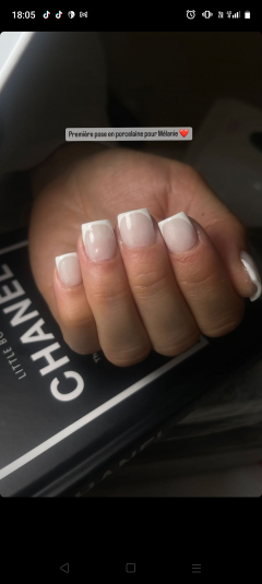 Service : prothesiste ongulaire Service : prothesiste ongulaire