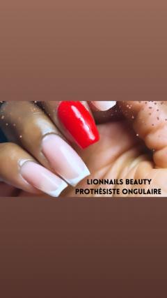 Service : prothesiste ongulaire Service : prothesiste ongulaire