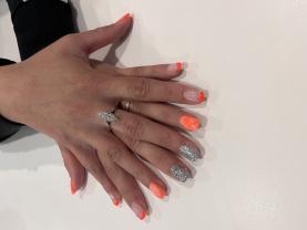 Service : prothesiste ongulaire Service : prothesiste ongulaire