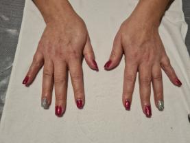 Service : prothesiste ongulaire Service : prothesiste ongulaire