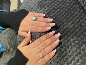 Service : prothesiste ongulaire Service : prothesiste ongulaire