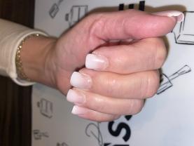 Service : prothesiste ongulaire Service : prothesiste ongulaire