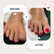 Service : prothesiste ongulaire Service : prothesiste ongulaire