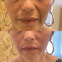 Service : estheticienne Service : estheticienne