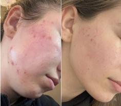 Service : soins Service : soins