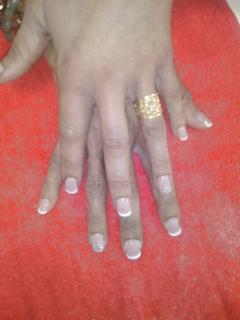 Service : prothesiste ongulaire Service : prothesiste ongulaire