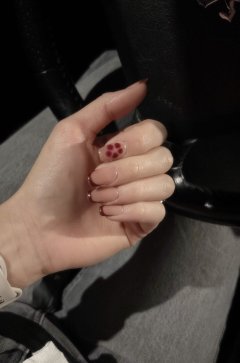 Service : prothesiste ongulaire Service : prothesiste ongulaire