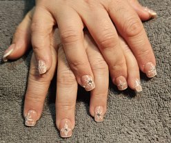 Service : prothesiste ongulaire