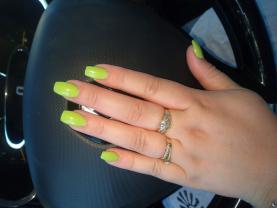 Service : prothesiste ongulaire Service : prothesiste ongulaire