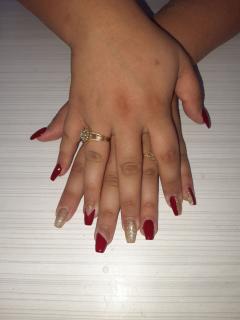 Service : prothesiste ongulaire Service : prothesiste ongulaire